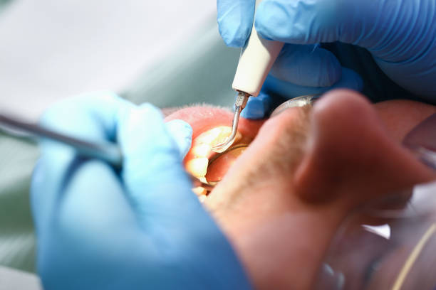 Best Emergency Denture Repair in Ocean Park, WA