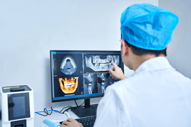 Best Emergency Wisdom Teeth Removal in Ocean Park, WA